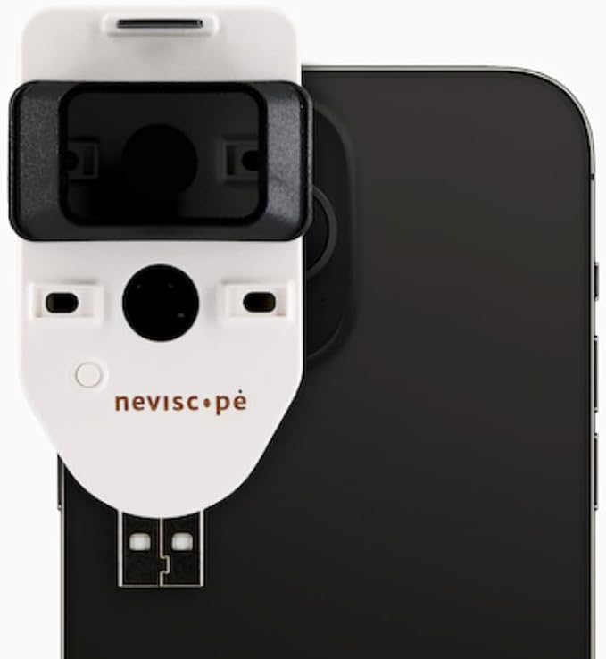 Neviscope Black Phone Dermatoscope Microscope with Polarized Lens/LED Light, 100x Camera Attachment with Universal Clip for Most iPhone/Android Phones Free App