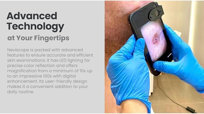 Neviscope Black Phone Dermatoscope Microscope with Polarized Lens/LED Light, 100x Camera Attachment with Universal Clip for Most iPhone/Android Phones Free App