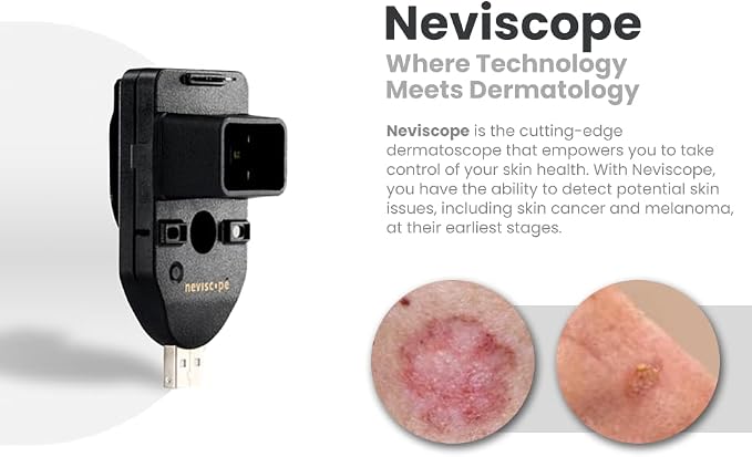 Neviscope Black Phone Dermatoscope Microscope with Polarized Lens/LED Light, 100x Camera Attachment with Universal Clip for Most iPhone/Android Phones Free App