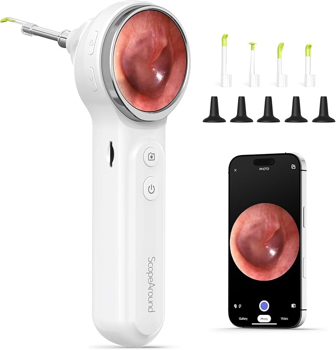 ScopeAround Otoscope with Light, Digital Otoscope w/IPS Screen, 720p HD Ear Wax Removal Tool Camera, Video Otoscope Ear Camera with 6 LED Lights, Compatible with Android/iPhone