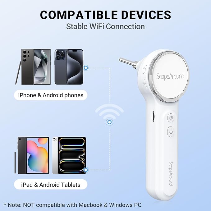 ScopeAround Otoscope with Light, Digital Otoscope w/IPS Screen, 720p HD Ear Wax Removal Tool Camera, Video Otoscope Ear Camera with 6 LED Lights, Compatible with Android/iPhone