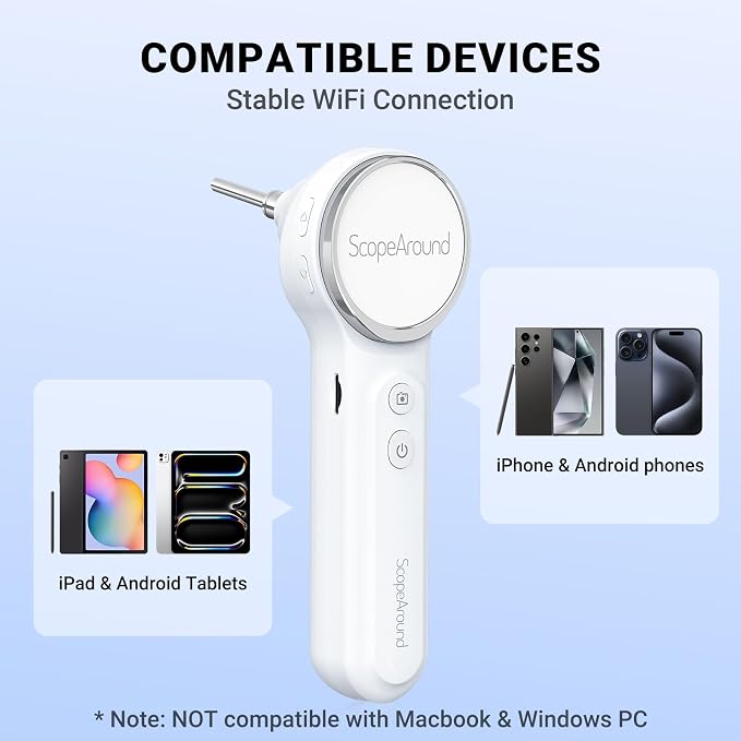 ScopeAround Digital Otoscope Camera w/Built-in Screen, Otoscope with Light Ear Scope for Home Use, Ear Light Otoscope with Camera, Easy Viewing for Everyday Ear Checks, Android/iPhone