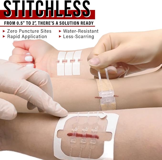 EVERLIT Wound Closure Kit | Surgical Zip-Stitch Devices for Cut & Laceration | Sterile, Suture-Free, Stitch-Less Adhesive Butterfly Bandages for Emergency First Aid Wound Care (Ultimate Pro+ Kit)