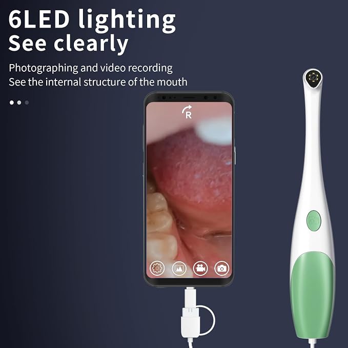Super Clear Intraoral Camera&Dental Camera,Visual Intraoral Camera Dental with Mirco USB/Type-C/USB Connector for Personal Home Teeth Inspection,Easy to Use for Android or PC