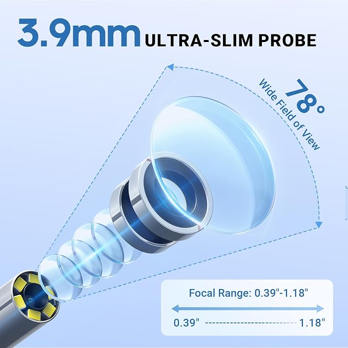 ScopeAround Digital Otoscope Camera w/Built-in Screen, Otoscope with Light Ear Scope for Home Use, Ear Light Otoscope with Camera, Easy Viewing for Everyday Ear Checks, Android/iPhone