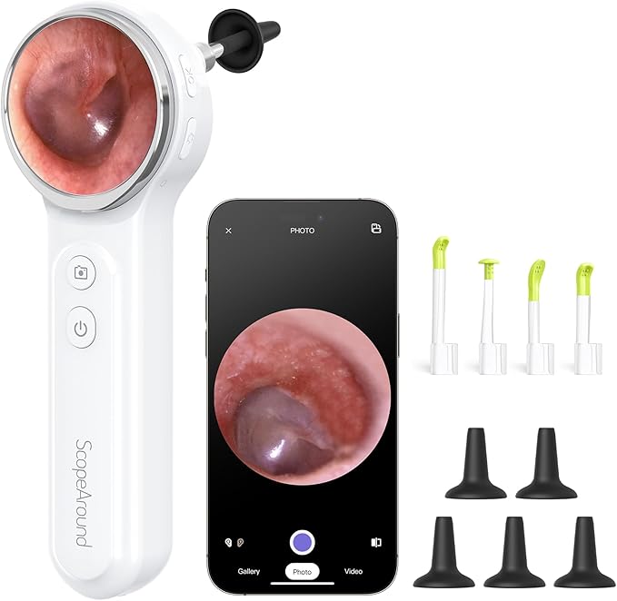 ScopeAround Digital Otoscope Camera w/Built-in Screen, Otoscope with Light Ear Scope for Home Use, Ear Light Otoscope with Camera, Easy Viewing for Everyday Ear Checks, Android/iPhone