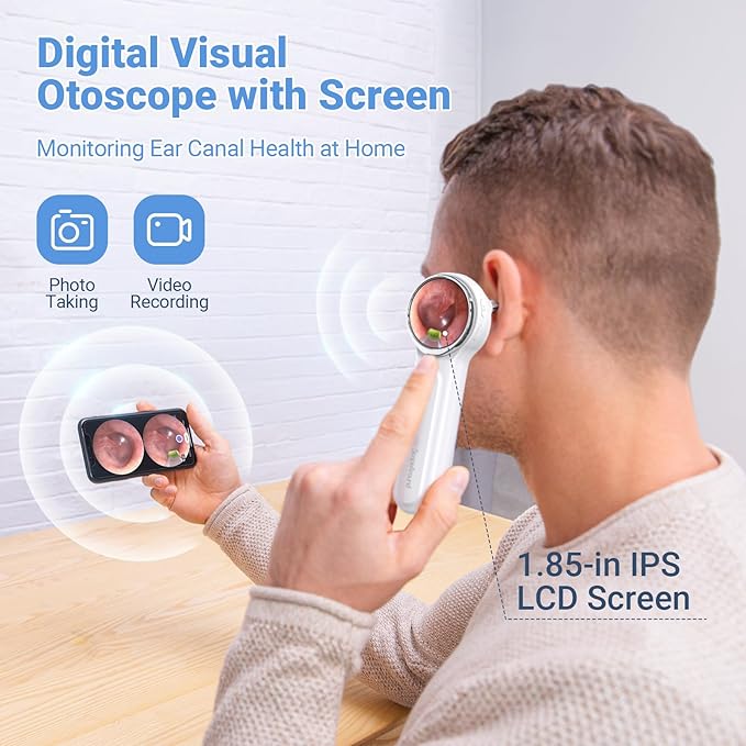 ScopeAround Otoscope with Light, Digital Otoscope w/IPS Screen, 720p HD Ear Wax Removal Tool Camera, Video Otoscope Ear Camera with 6 LED Lights, Compatible with Android/iPhone