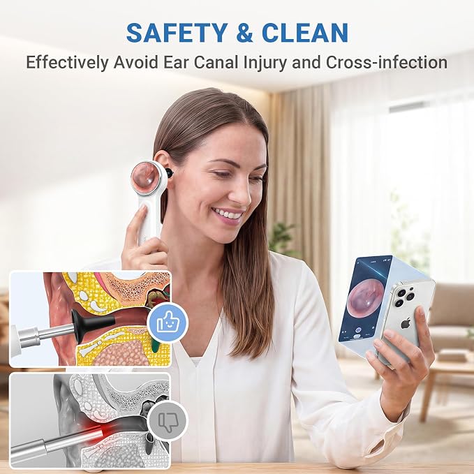 ScopeAround Digital Otoscope Camera w/Built-in Screen, Otoscope with Light Ear Scope for Home Use, Ear Light Otoscope with Camera, Easy Viewing for Everyday Ear Checks, Android/iPhone