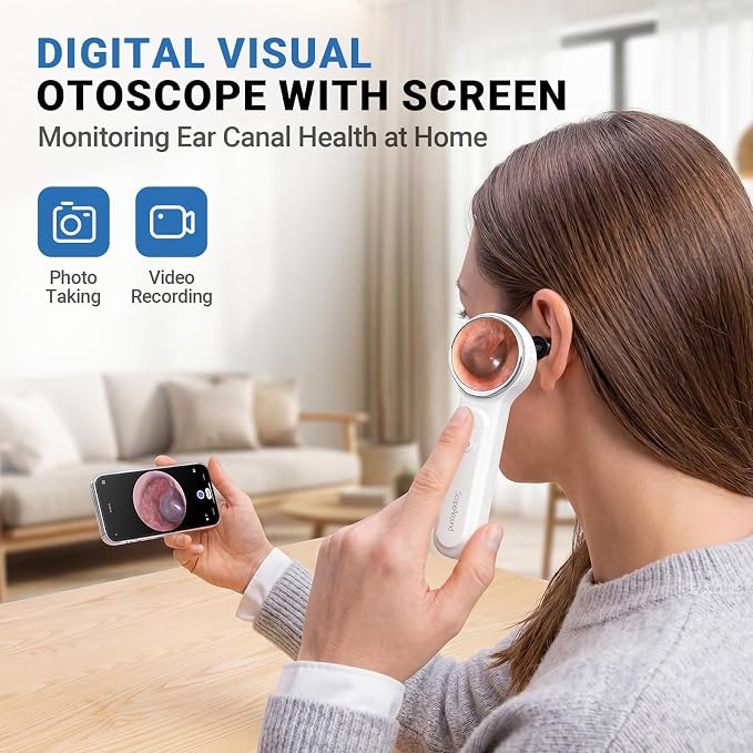 ScopeAround Digital Otoscope Camera w/Built-in Screen, Otoscope with Light Ear Scope for Home Use, Ear Light Otoscope with Camera, Easy Viewing for Everyday Ear Checks, Android/iPhone