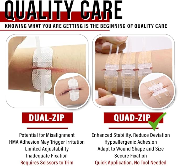 EVERLIT Wound Closure Kit | Surgical Zip-Stitch Devices for Cut & Laceration | Sterile, Suture-Free, Stitch-Less Adhesive Butterfly Bandages for Emergency First Aid Wound Care (Ultimate Pro+ Kit)