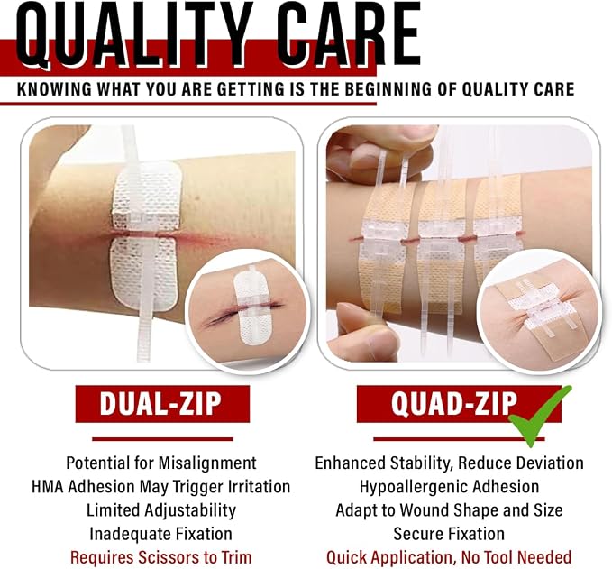 EVERLIT Wound Closure Kit | Surgical Zip-Stitch Devices for Cut & Laceration | Sterile, Suture-Free, Stitch-Less Adhesive Butterfly Bandages for Emergency First Aid Wound Care (6 Zip Complete Kit)