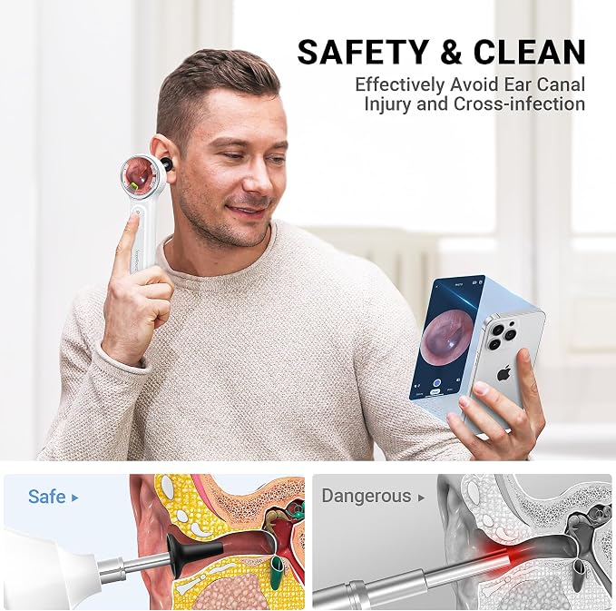 ScopeAround Otoscope with Light, Digital Otoscope w/IPS Screen, 720p HD Ear Wax Removal Tool Camera, Video Otoscope Ear Camera with 6 LED Lights, Compatible with Android/iPhone